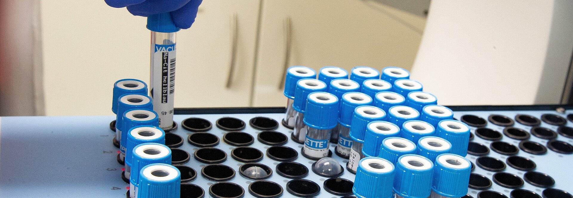 Probenentnahme in der Laboratoriumsmedizin