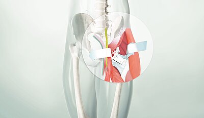 AMIS Methode AMIS Methode